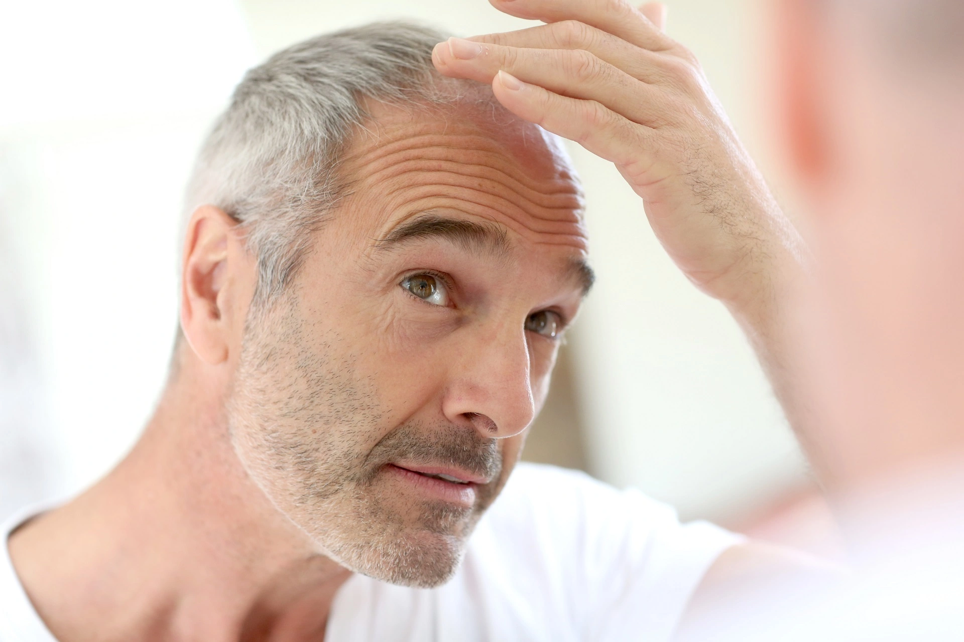 Hair Loss Therapy Benefits in New Rochelle, NY