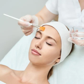YAS Custom Total Peel Package (3 sessions)